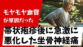 【美品】遠絡療法　医師　坐骨神経痛　三叉神経　帯状疱疹　疼痛　クリニック　治療 帯状疱疹後神経痛 - 葛飾区新小岩・おぐち針灸院で初めてでも