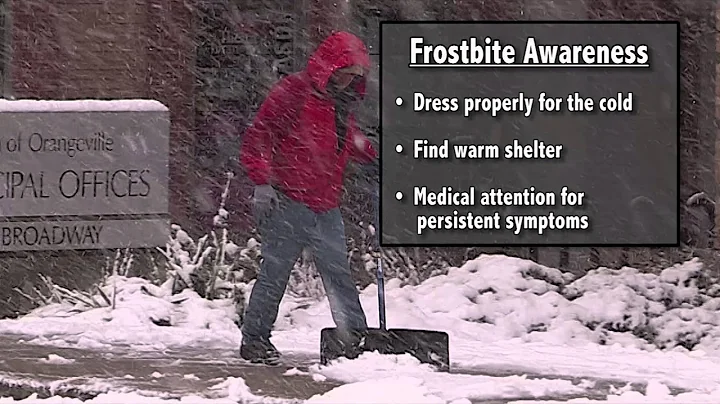 Frostbite Awareness Tips from the National Weather Service