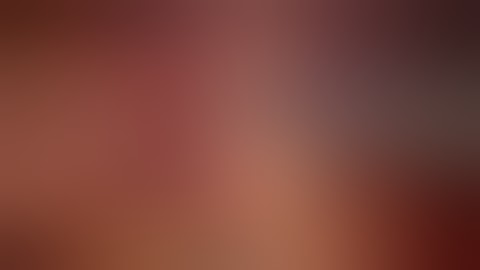 Robotic video endoscopic inguinal lymphadenectomy (RVEIL)