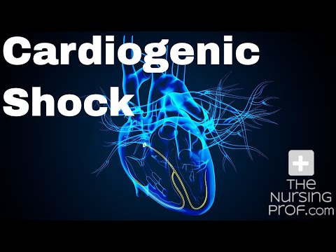 How to Manage Cardiogenic Shock