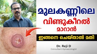 മുലകണ്ണിലെ വിണ്ടുകീറൽ മാറാൻ ഇങ്ങനെ ചെയ്താൽ മതി | Cracked Nipples home remedies | Dr. Reji D