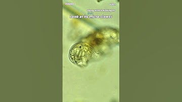 Creek Water Tardigrades Under Microscope (Baby Water Bear)