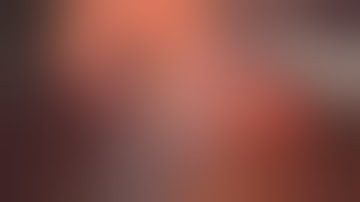 Laparoscopic dissection of 11d & 10 lymph-node stations