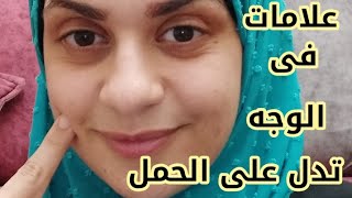 علامات الحمل من الوجه