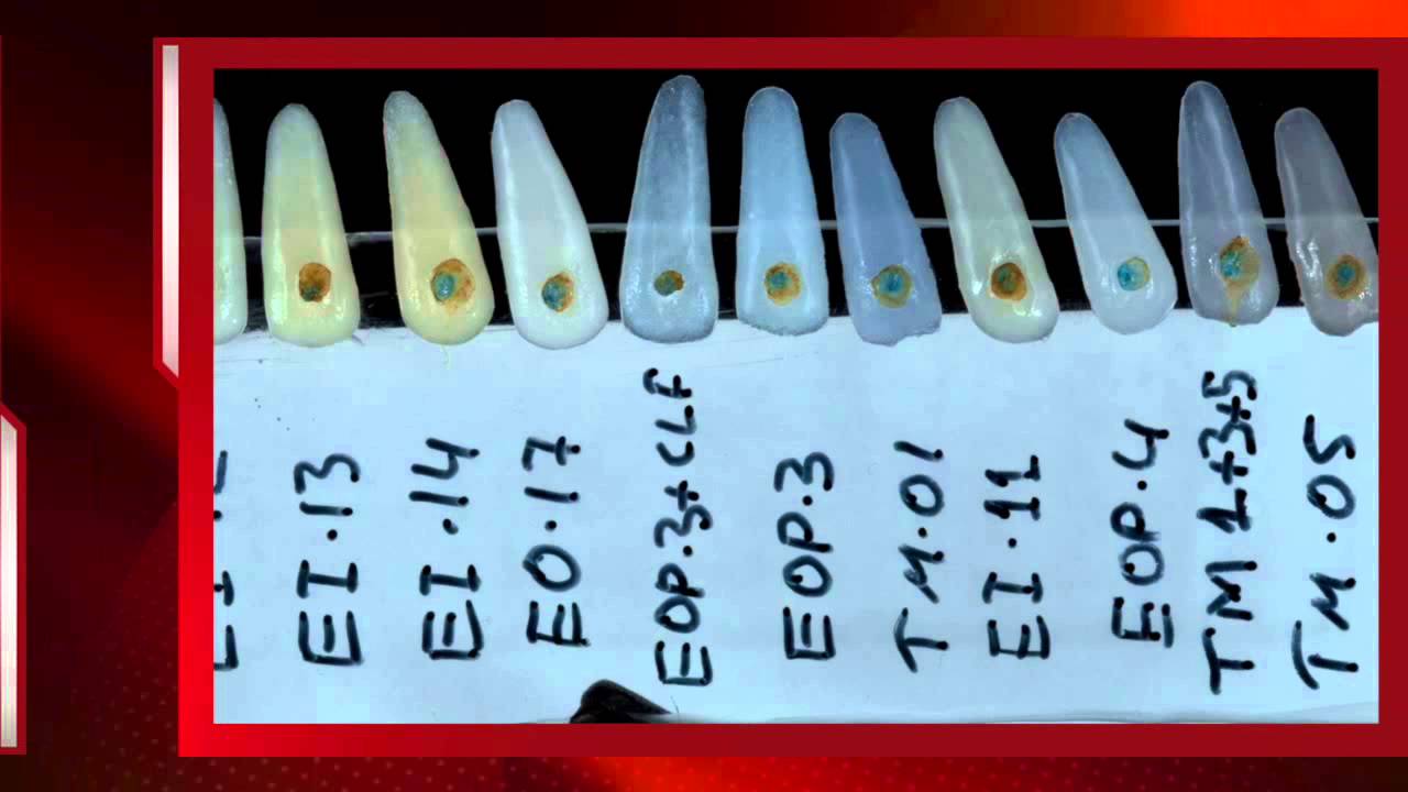 Dental ceramic custom color guides. YouTube