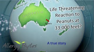Life Threatening Reaction To Peanuts At 33,000 Feet?