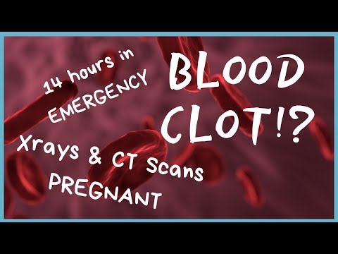 Emergency Department Story | Blood Clot Scare