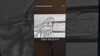 *"एम्ब्रियो बायोप्सी: जानिए पूरी प्रक्रिया"*- *"आईवीएफ में एम्ब्रियो बायोप्सी @BoneBiopsy