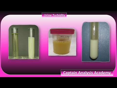   عكاره البول واسبابها