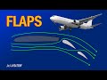 What are flaps  when are flaps used  advantages and different types of flaps 