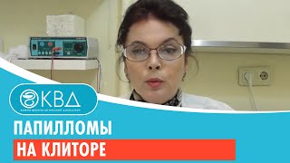 картинка: 👩 1486  Папилломы на клиторе