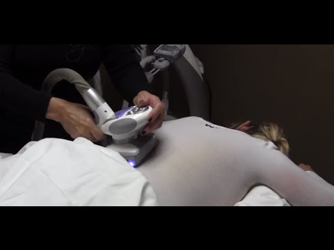 Dr. Milan Shah Explains What Endermologie Is And What It Does.