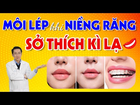 Video: Các Chuyên Gia Thẩm Mỹ Cho Rằng Leontyev đã Thực Hiện Chỉnh Sửa Môi Trong Quá Khứ