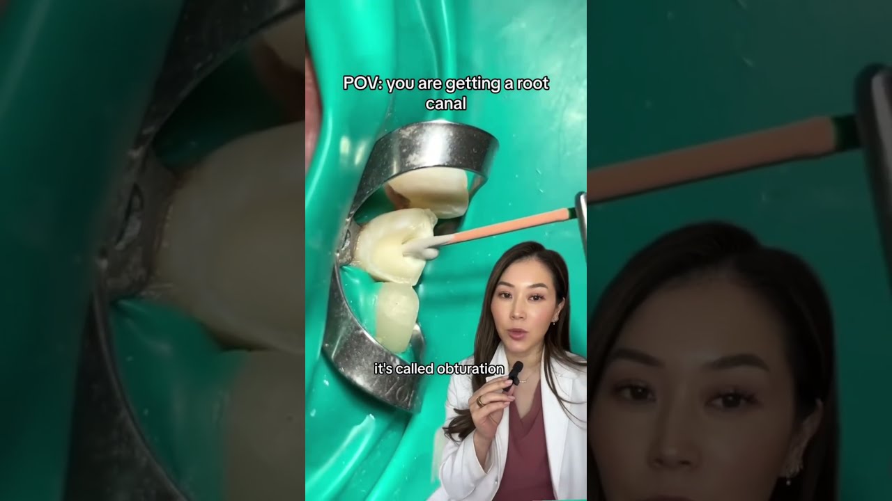 Getting A Root Canal On Front Tooth Rootcanal Cavity Dentist Dentalwork