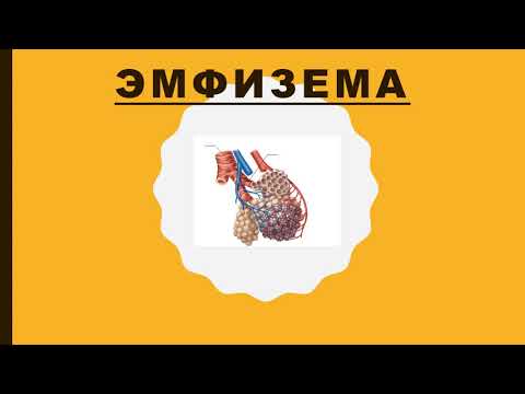 Эмфизема легких -