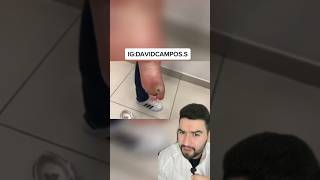 Tenía Gusanos En El Pie