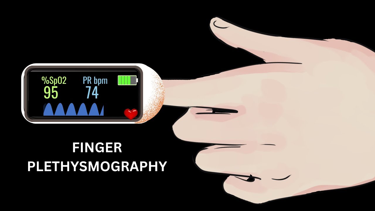 Py5 16 arterial pulse tracing using finger plethysmography pulse
