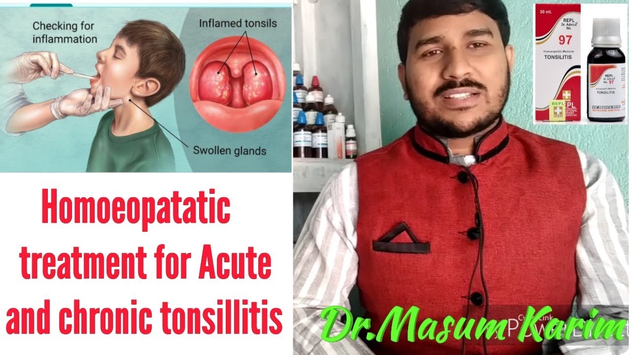 Acute and chronic tonsillitis के लिय होमियोपैटेटिक दवा! SBL TONSILAT | Repl No97| Dr.Masum Karim