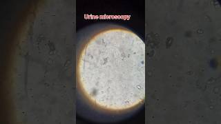 Urine microscopy structure | Crystal | Caste cell #urinalysis #pathology #lab #status #shorts #dmlt