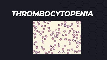 Thrombocytopenia