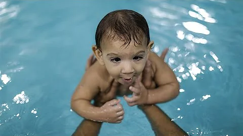 Como é a cabeça de quem tem microcefalia?