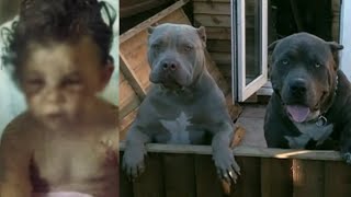 Five Pit Bulls Tore 2-Year-Old Girl Like A Piece Of Meat