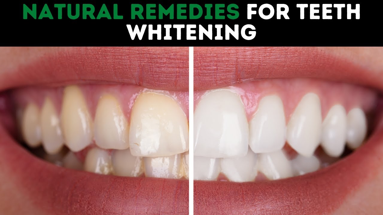 natural-remedies-for-teeth-whitening-youtube