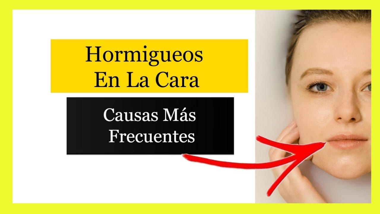 Hormigueo En La Cara【Descubre Porque Te Hormiguea La Cara】 YouTube Hormigueo En La Cara【Descubre Porque Te Hormiguea La Cara】 YouTube