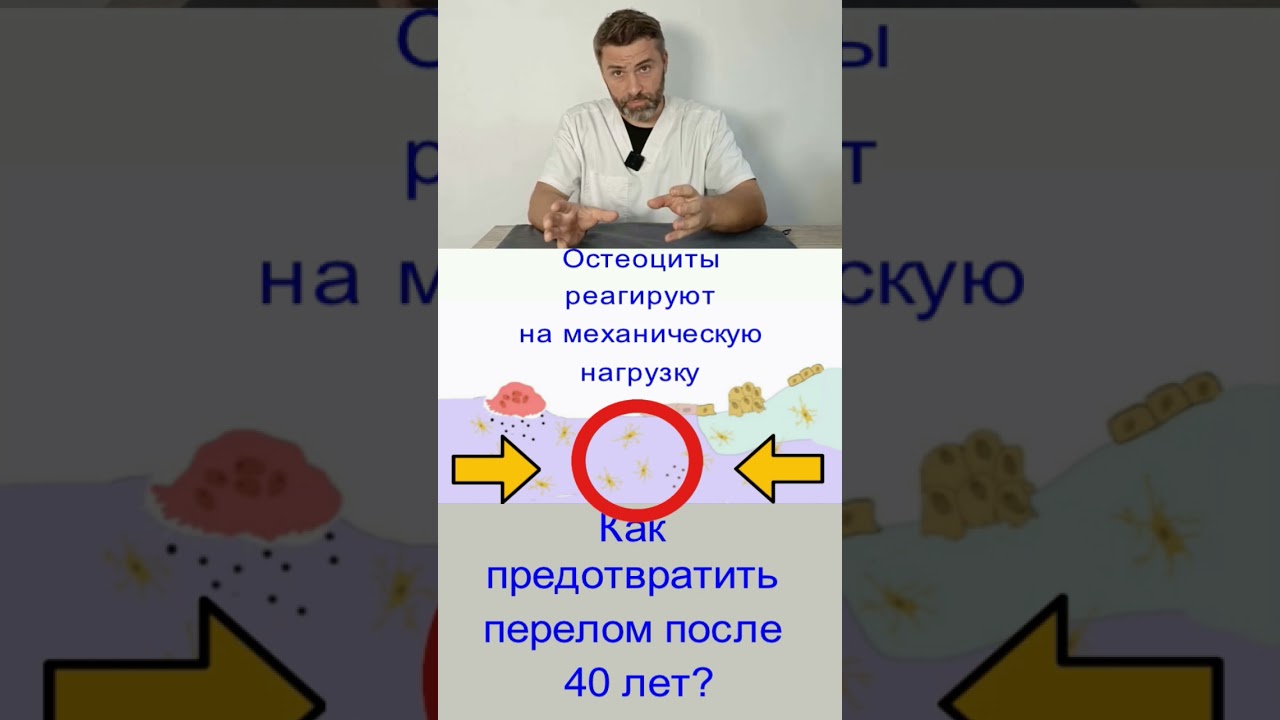 Как предотвратить перелом после 40 лет?