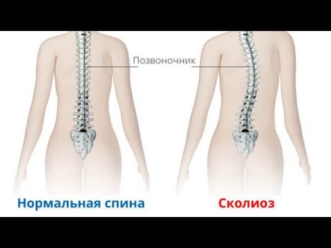 Олар менің кискамды қолдарымен қатты созды (фото) Олар менің кискамды қолдарымен қатты созды (фото)