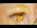 ASMRビジュアルヒーリング：耳掃除の美しい手順