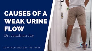 Causes of a Weak Urine Flow - Dr. Jonathan Jay Resimi