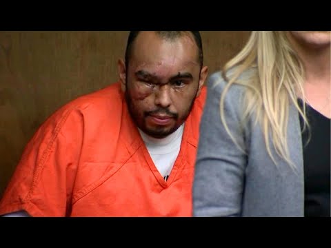 Man charged in crash that killed cop appears in court with major bruises, scars
