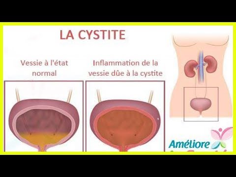 Vidéo: Miction Difficile, Douloureuse Et Fréquente Chez Les Furets