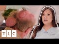 Dr. Pimple Popper Tackles These ENORMOUS Cysts I Dr. Pimple Popper: Pop Ups