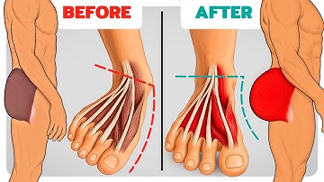 How Strong Glutes Fix Flat Feet & Weak Ankles (Science-Based)