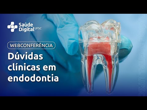 Webseminário - Dúvidas clínicas em endodontia Webseminário - Dúvidas clínicas em endodontia