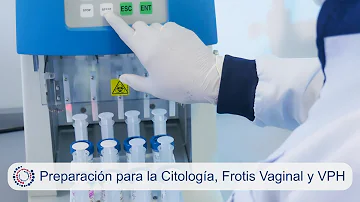 ¿Con qué frecuencia debo hacerme una citología si tengo el VPH?