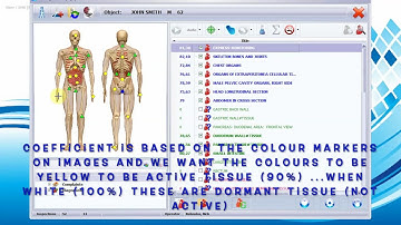 Sensitiv Imago (SI) Key Concepts: How to Asses After a Scan: Part 2