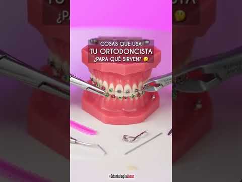 Video: Cómo convertirse en ortodoncista (con imágenes)