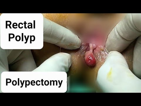 Berkova bilan rus super porno