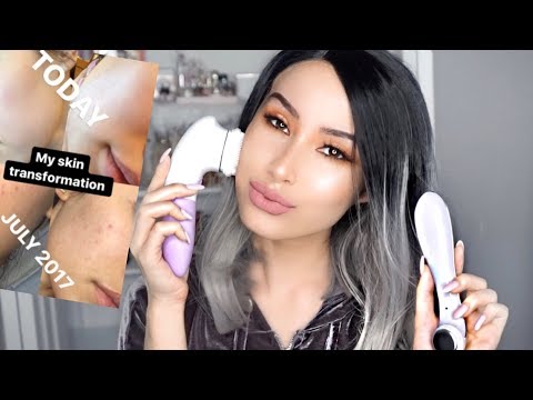 SKINCARE DEVICES THAT SAVED MY SKIN!! + HUGE Vanity Planet Discount code!