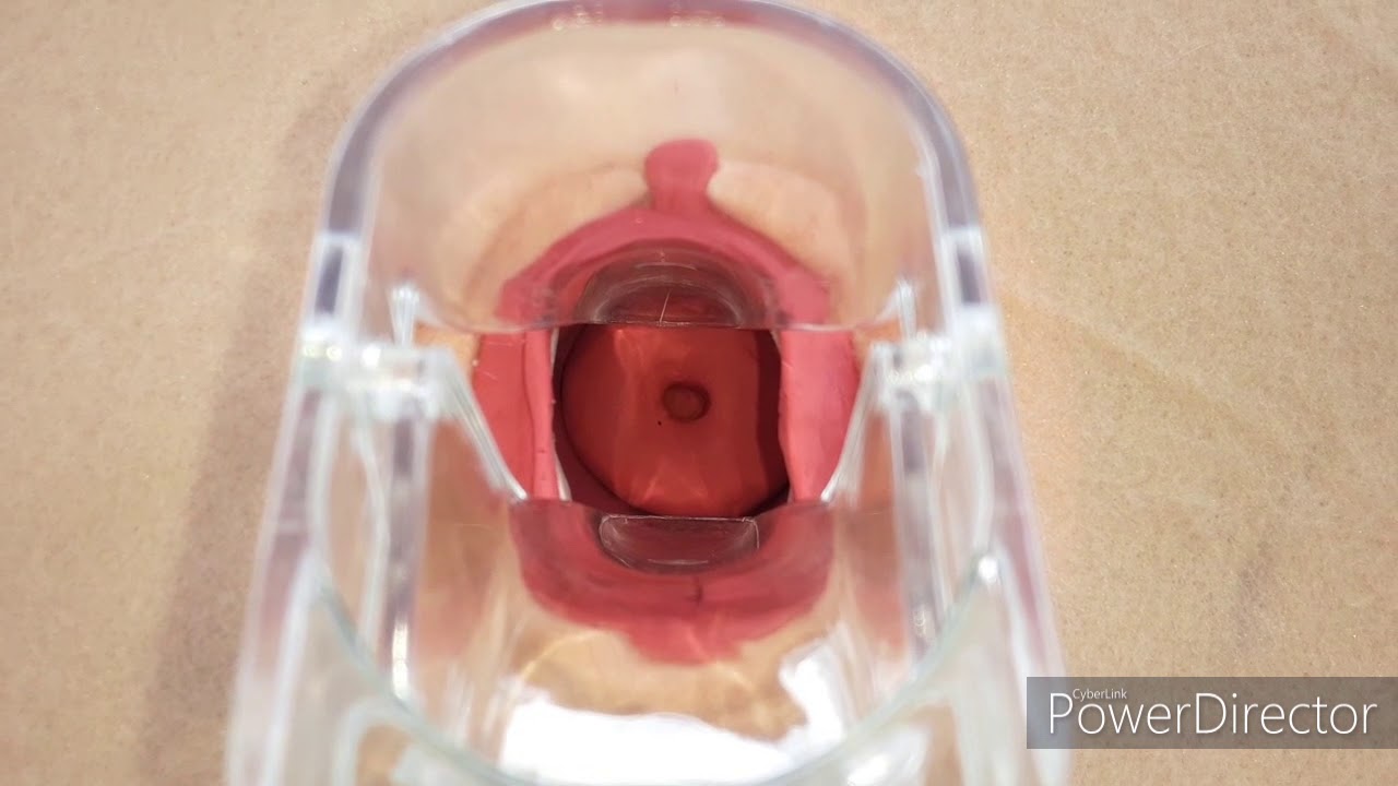 Процедура взятия мазка Папаниколау