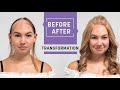 Alopecia areata: A wig for a 13-year-old | Transformation with hey2go wig | Hairsystems Heydecke