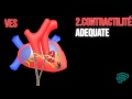  explication claire et astuces pour apprendre la regulation du debit cardiaque   dr astuce