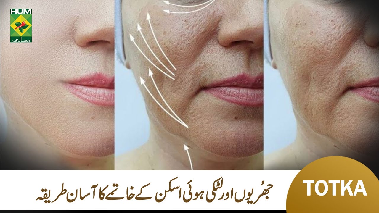 Loose Skin Tightening Remedies at Home | Natural Totkay | Umme Raheel | Masala TV