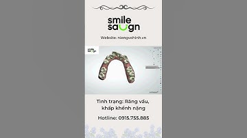 Phác đồ niềng răng vẩu, khấp khểnh - Smilesalign