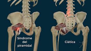 Músculo Piriforme o Piramidal de la Pelvis | Ciática vs Falsa Ciática