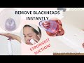 TIPS ON HOW TO USE BLACKHEAD VACUUM| BEST Blackhead Suction/Remover| REMOVE BLACKHEADS INSTANTLY!