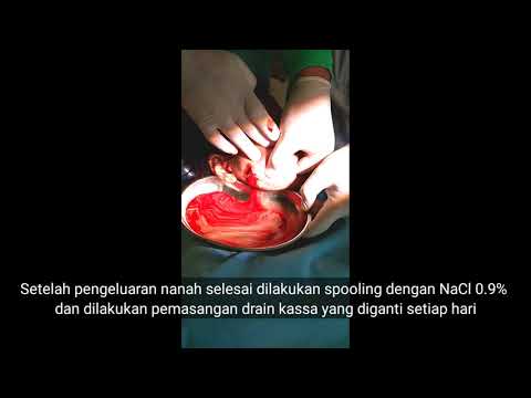 Video: Abses Dalaman Dalam Reptilia